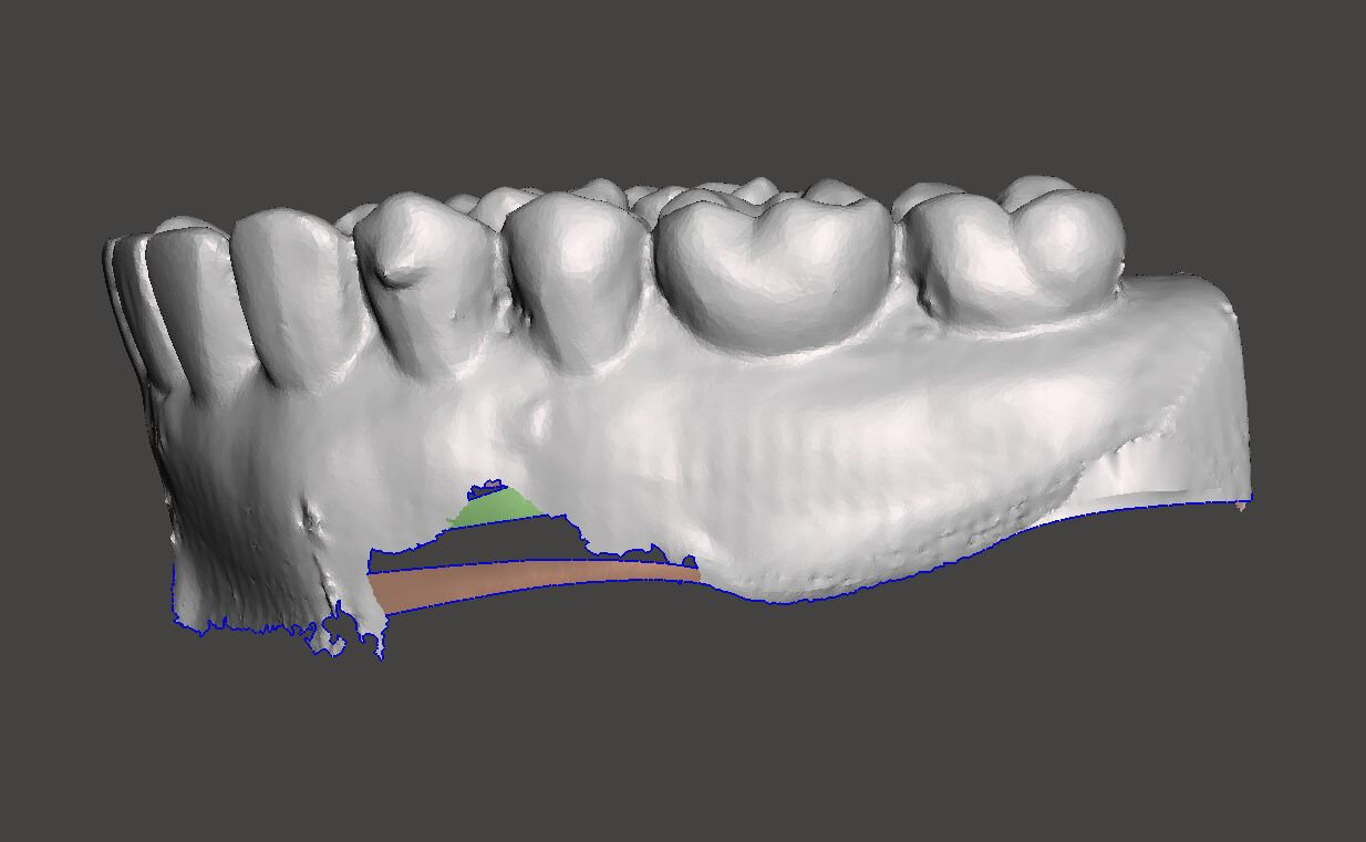 image-1-1
