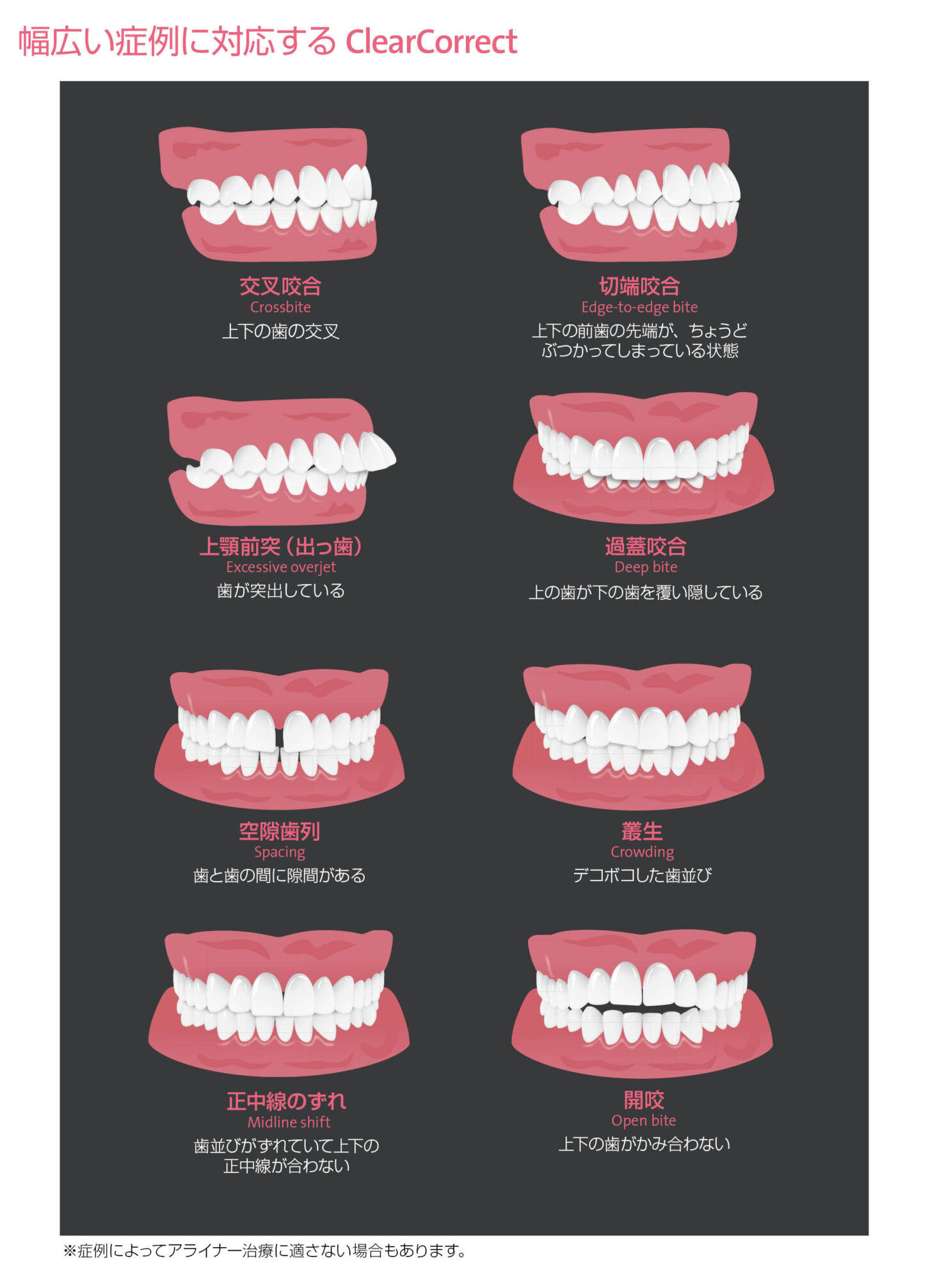治療可能な症例_イラスト