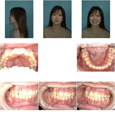 [TN640x400]-VOI44732137_composite_picture