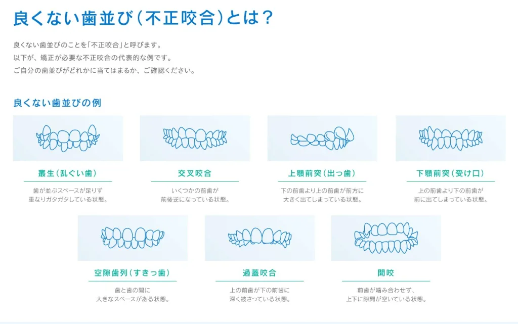 良くない歯並び