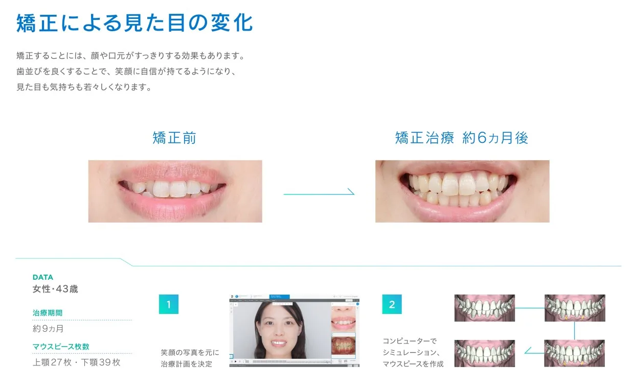 suresmile4